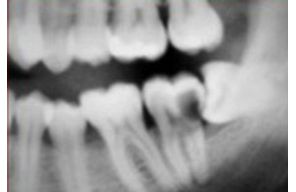 //www.cursoslivresead.com.br/cirurgia-de-dentes-inclusos-384/p