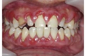 //www.cursoslivresead.com.br/periodontia-medica---estudo-sistemico-das-doencas-periodontais-745/p