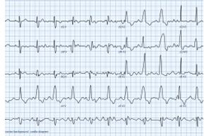 //www.cursoslivresead.com.br/eletrocardiograma-para-enfermeiros-1139/p
